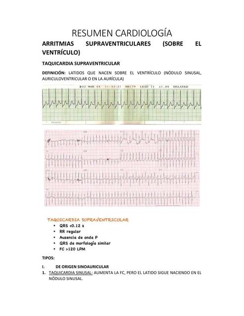 Apuntes de Arritmias y Bloqueos AEM