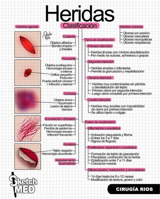 Heridas clasificacion