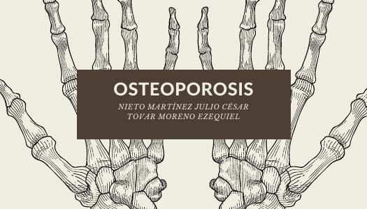 OSTEOPOROSIS