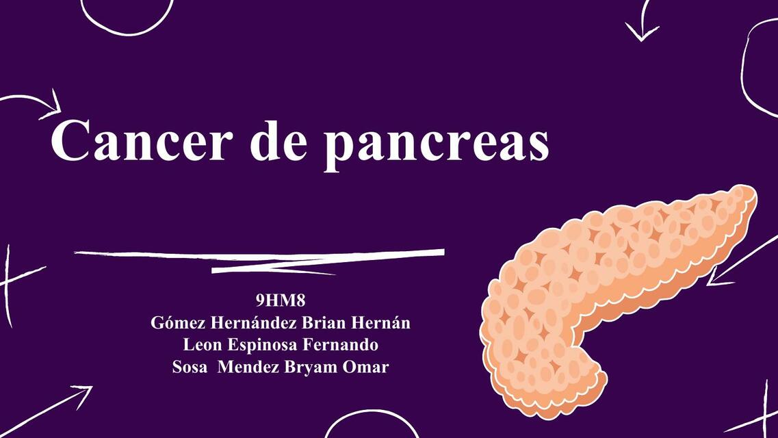 CANCER DE PANCREAS