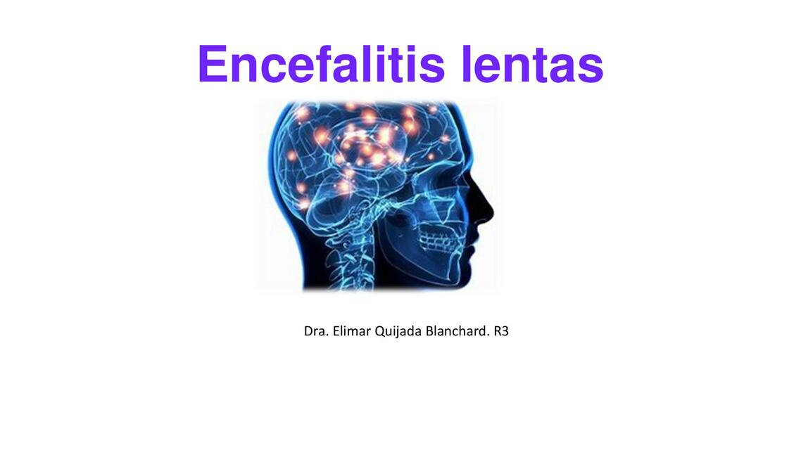 Encefalitis lentas