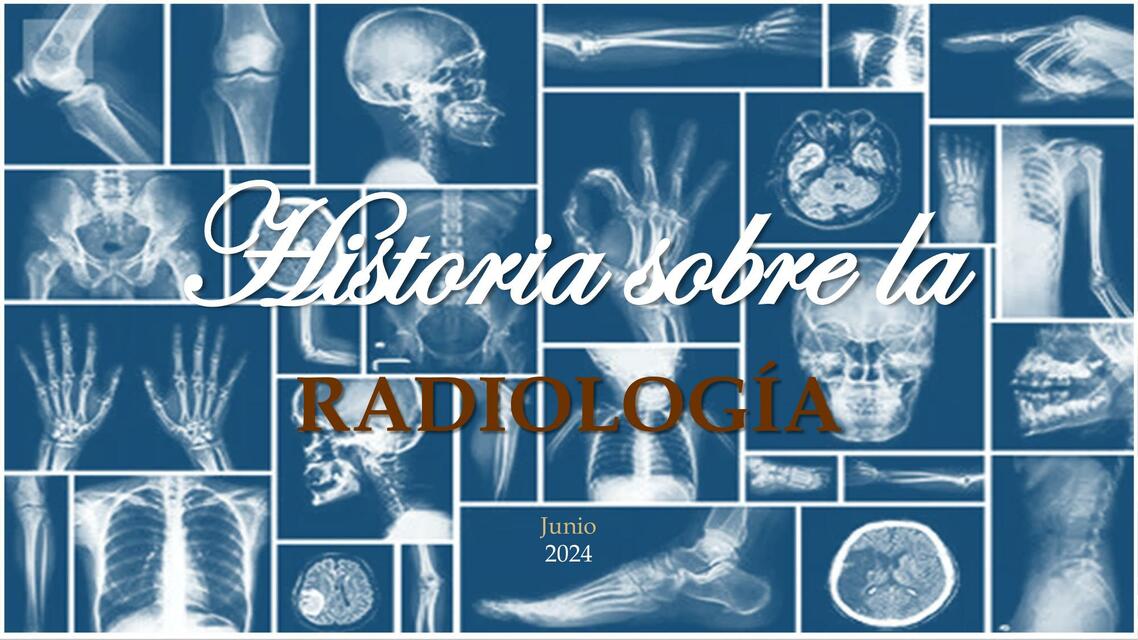 Historia Radiología