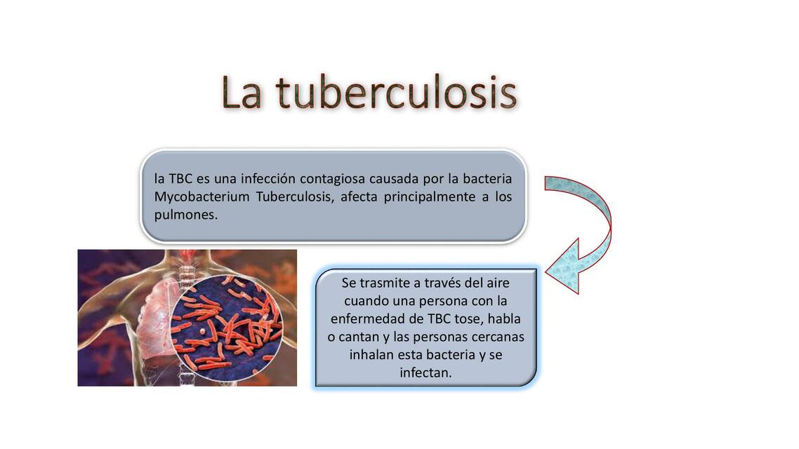 La tuberculosis 