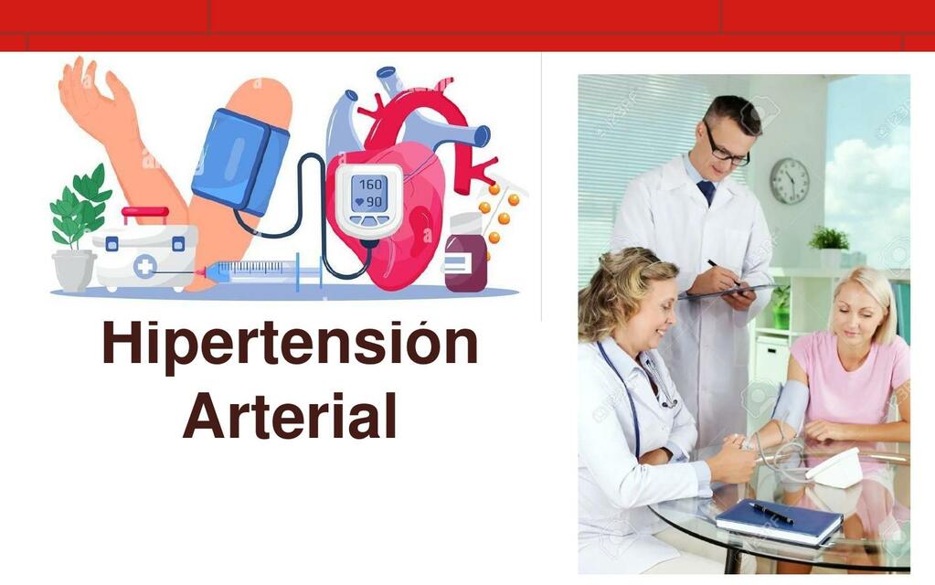 hipertensión arterial mañana