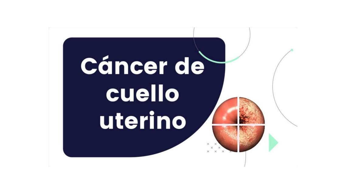 Cancer de Cuello uterino