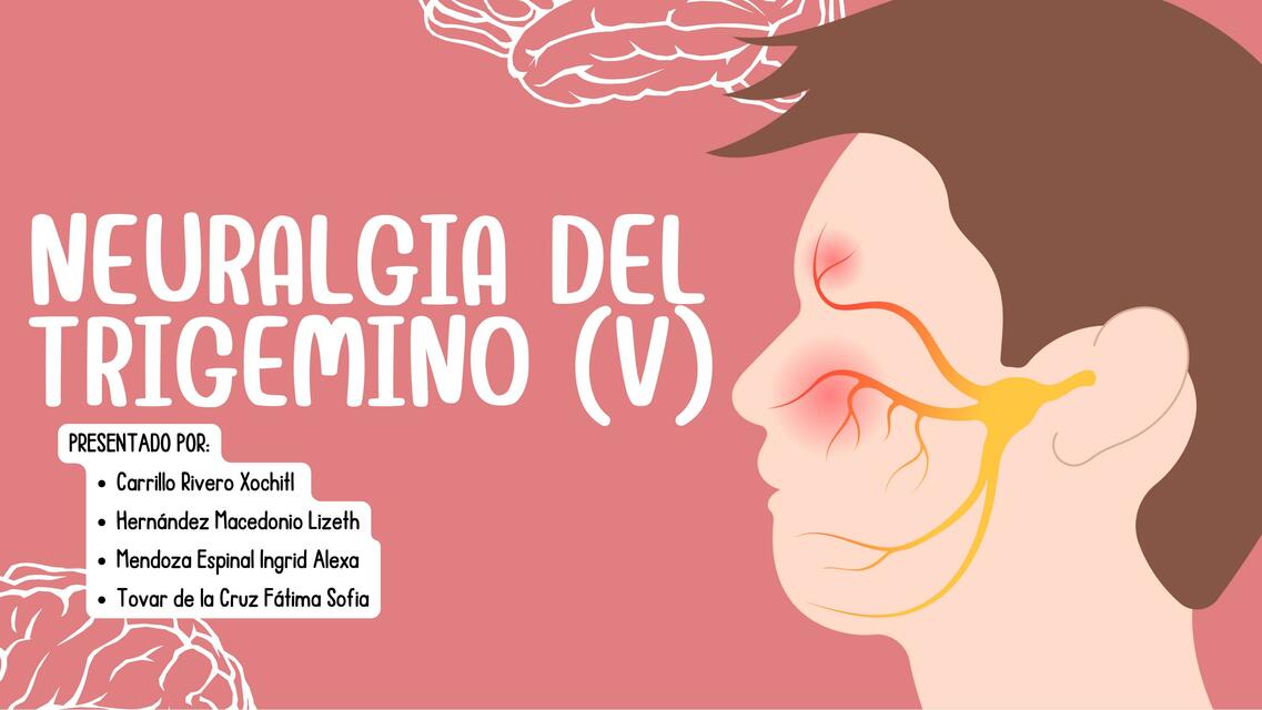 NEURALGIA DEL TRIGÉMINO