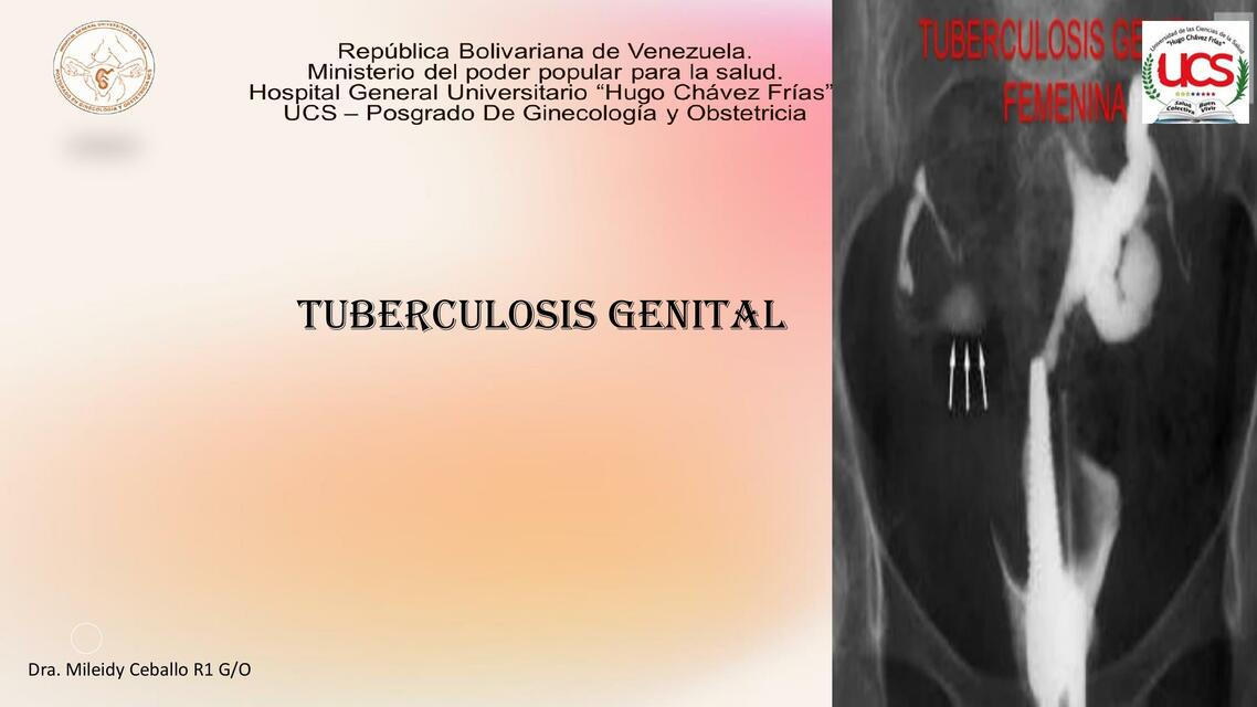 Tuberculosis genital 