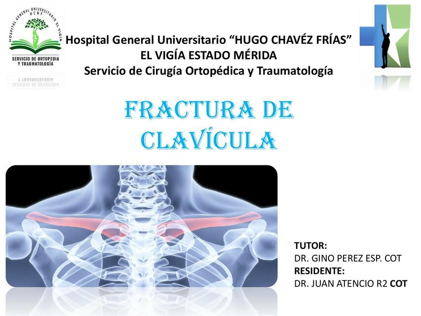 Clavicula