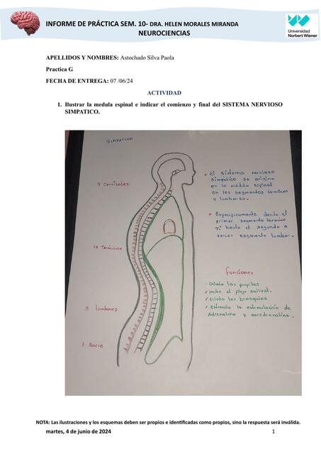 INFORME DE PRACTICA SEMA 10