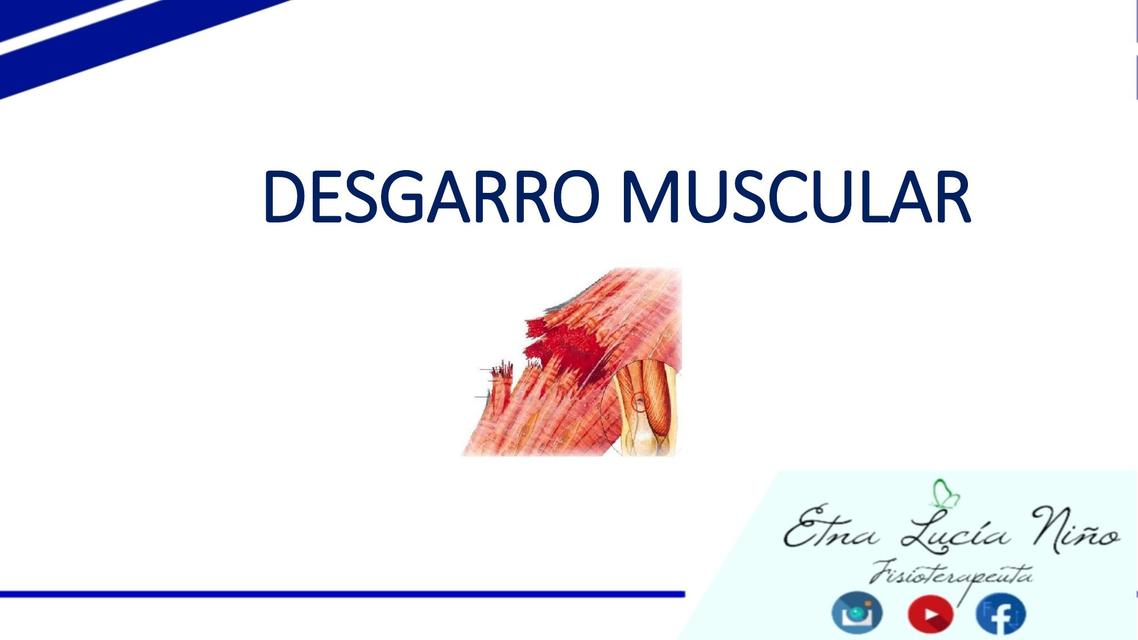 DESGARRO MUSCULAR