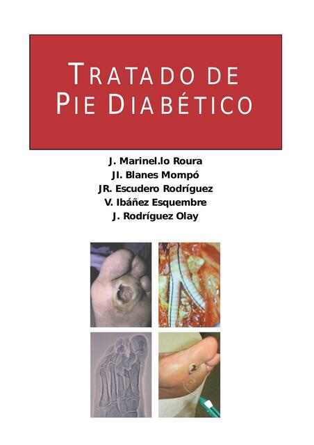 Tratado de pie diabético 