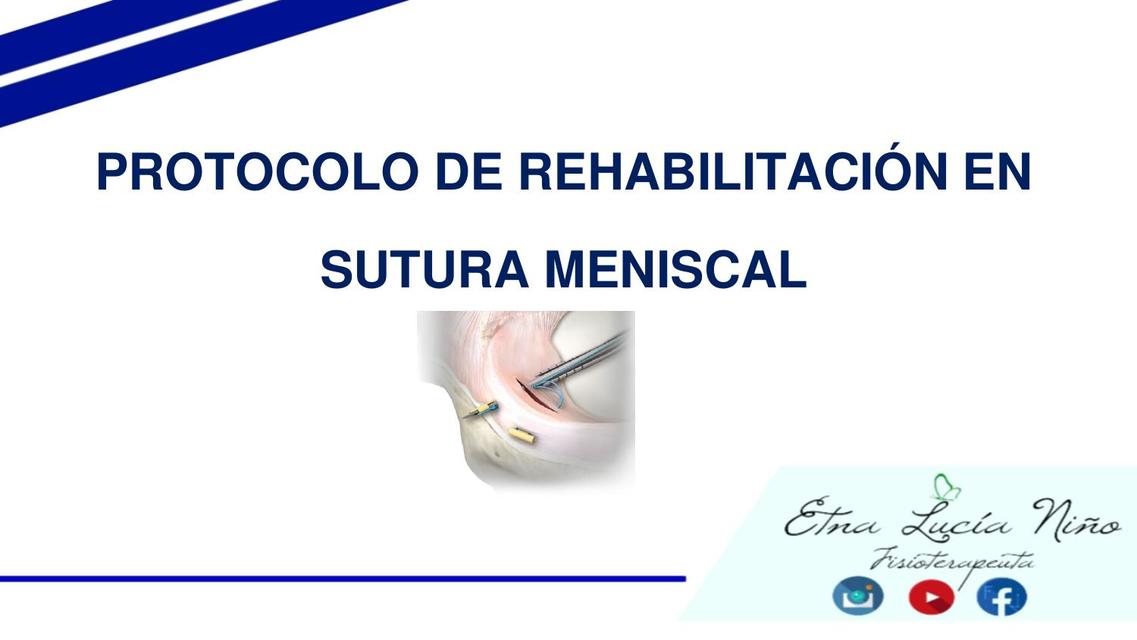 PROTOCOLO DE REHABILITACIÓN SUTURA MENISCAL