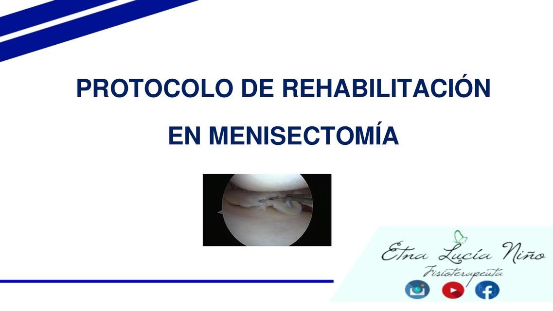 PROTOCOLO DE REHABILITACION EN MENISECTOMIA