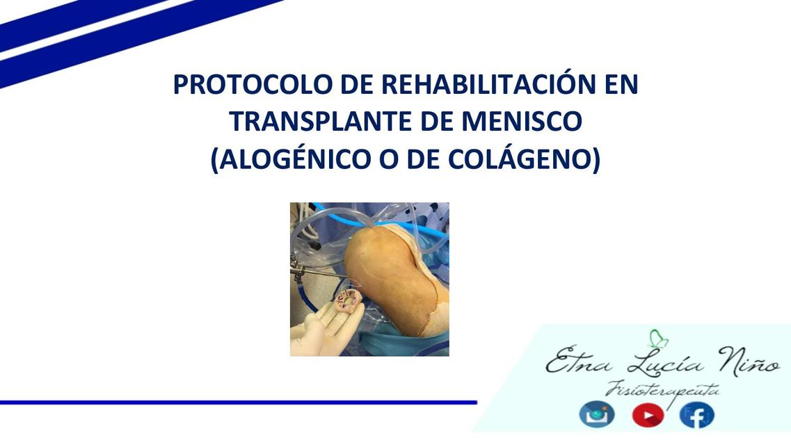 PROTOCOLO REHABILITACIÓN TRANSPLANTE DE MENISCO