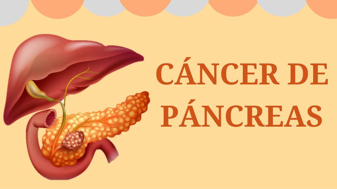 CÁNCER DE PÁNCREAS