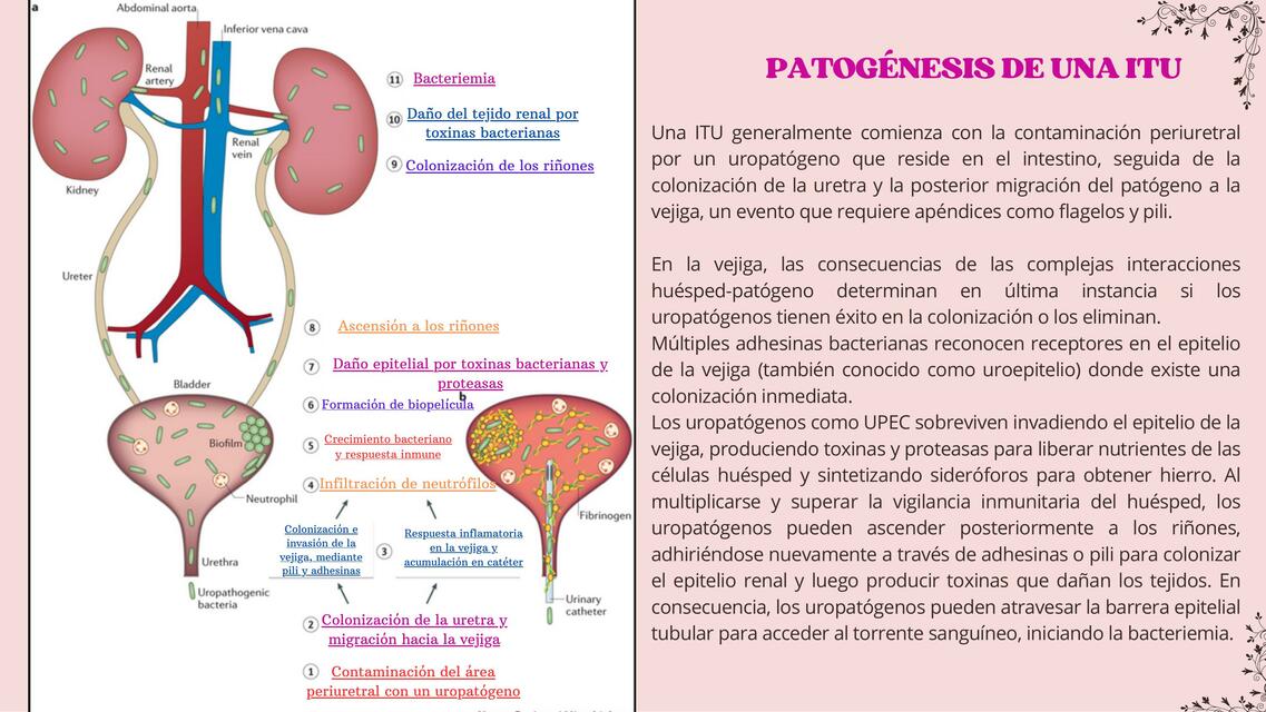 Infecciones en el sistema urinario