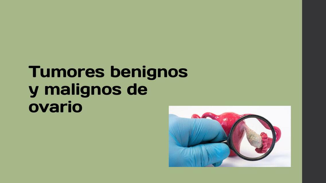 Tumores benignos y malignos de ovario