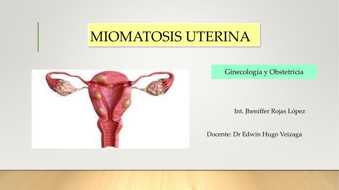 MIOMATOSIS UTERINA