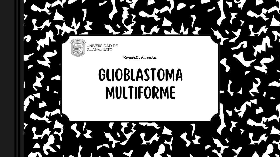 Reporte de caso: Glioblastoma multiforme