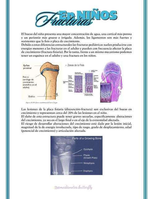 FRACTURAS EN NINOS