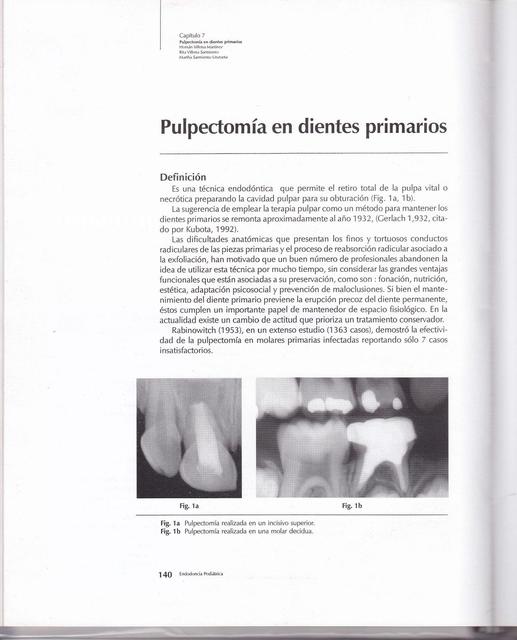 PULPECTOMIAS Resumen 13 2