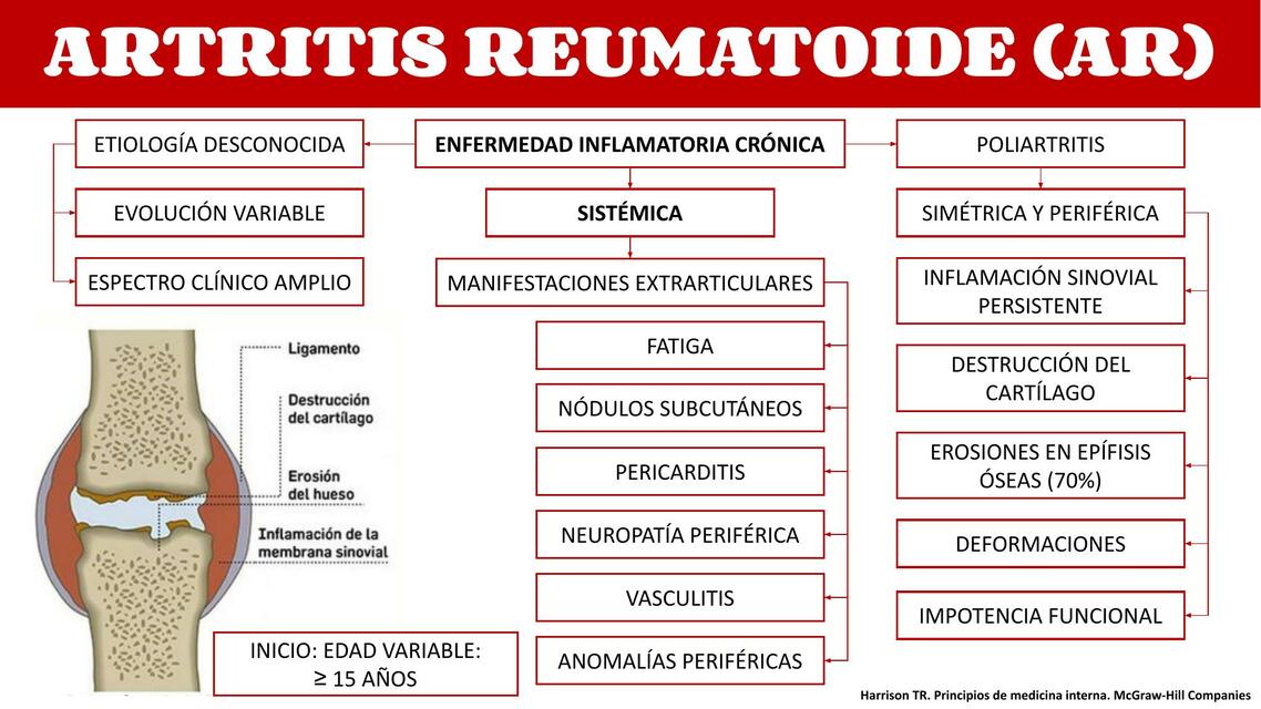 ARTRITIS REUMATOIDE