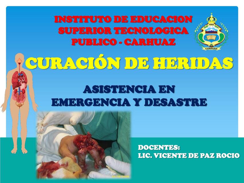 Curación de heridas 