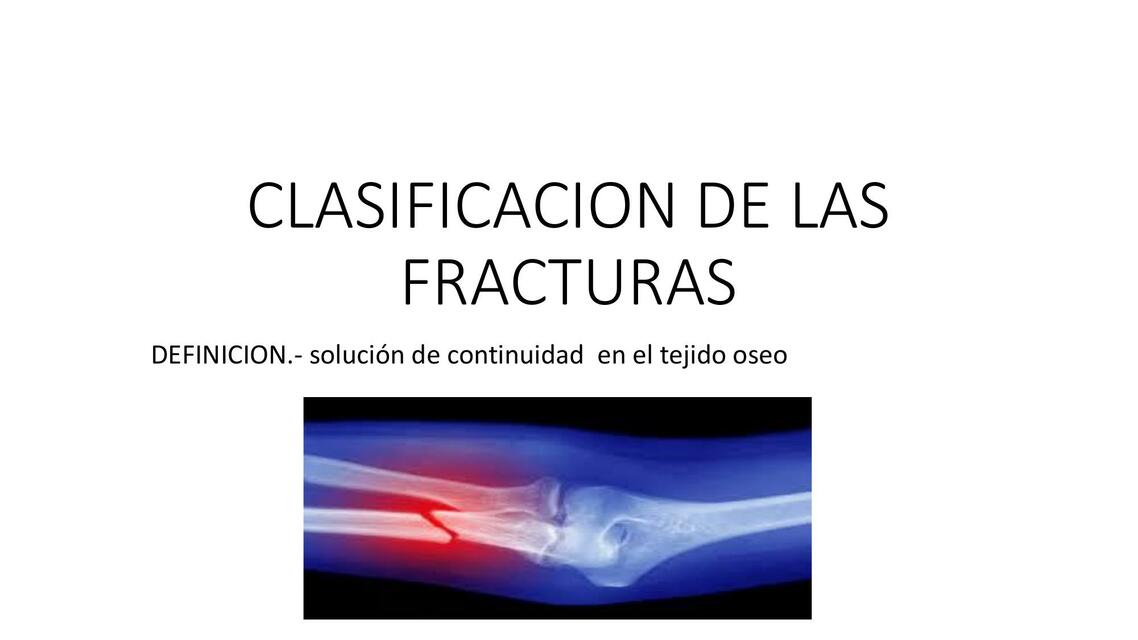 CLASIFICACION DE LAS FRACTURAS 2da clase