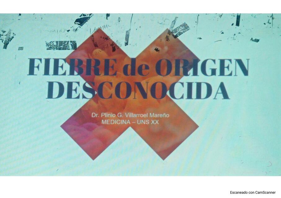 Fiebre de origen desconocida 