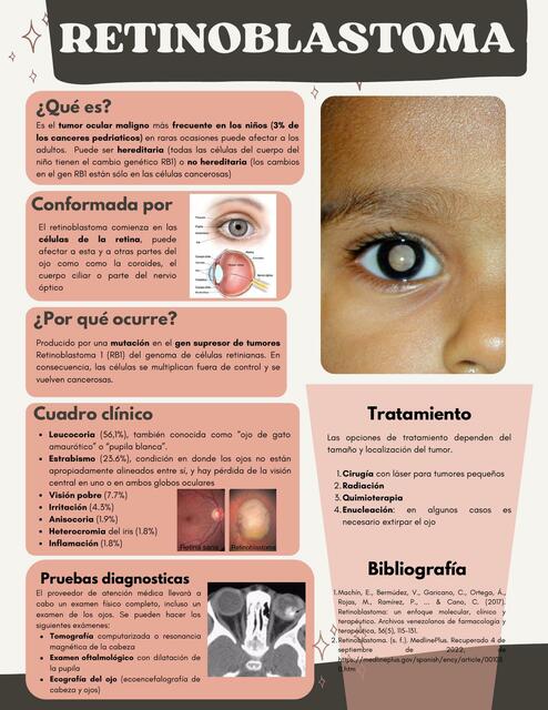 Retinoblastoma