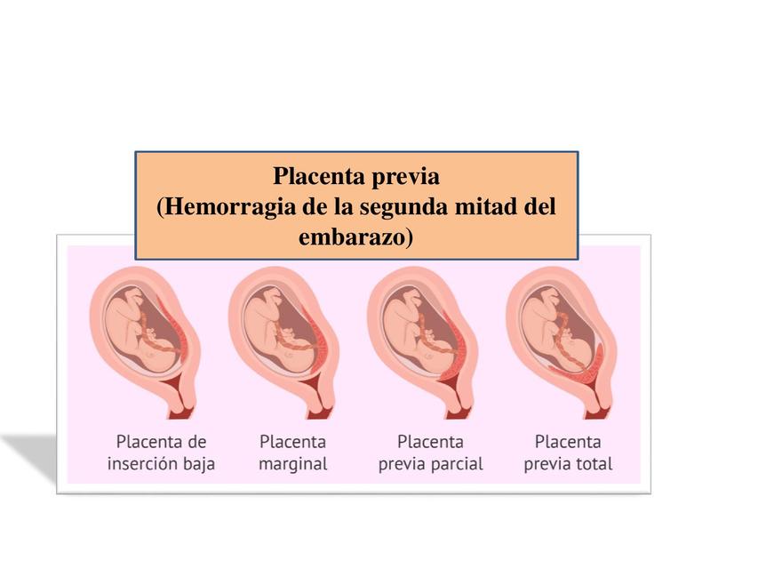 PLACENTA