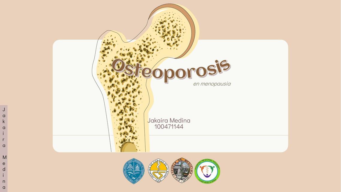 Osteoporosis en menopausia