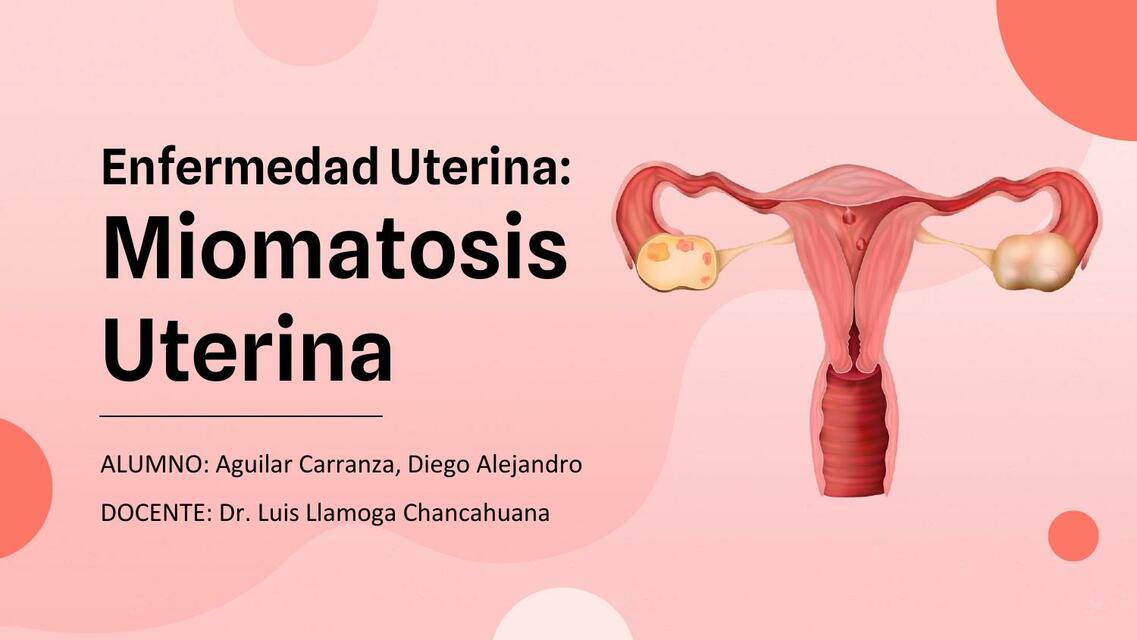 MIOMATOSIS UTERINA