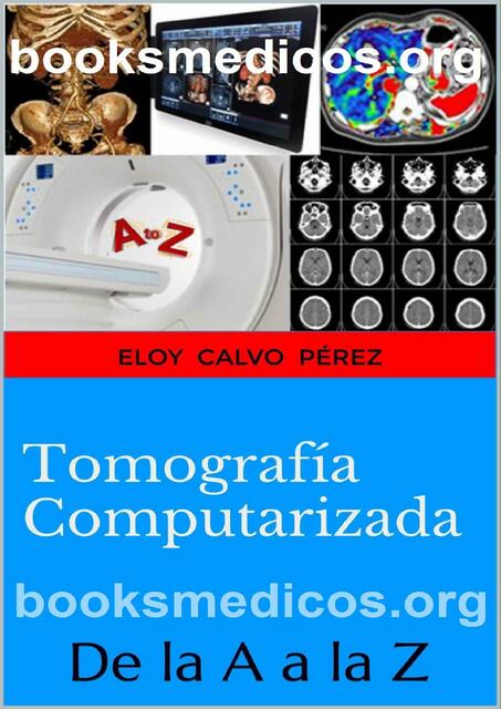 Tomografia Computarizada De la A a la Z