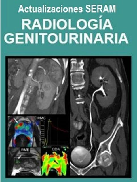 Radiologia Genitourinaria 