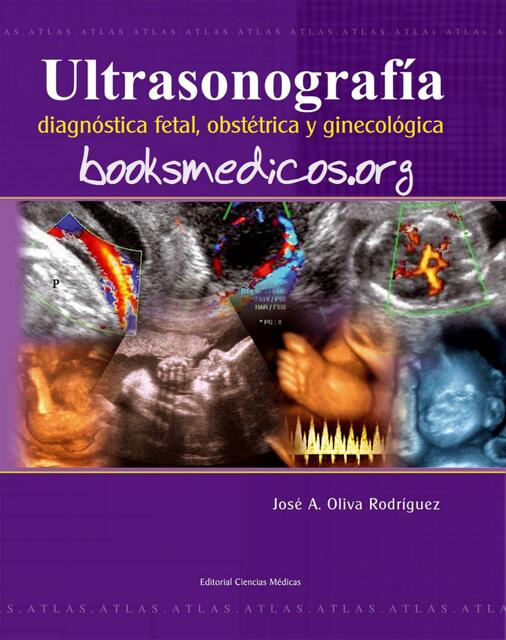 Ultrasonografia diagnostica fetal obstetrica y ginecología 