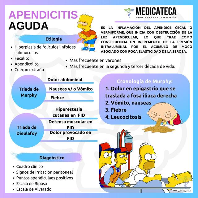 Apendicitis aguda