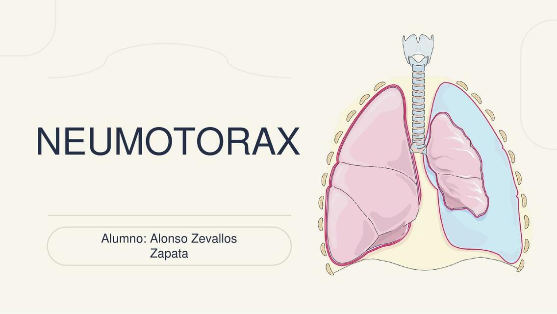 NEUMOTORAX EXPO