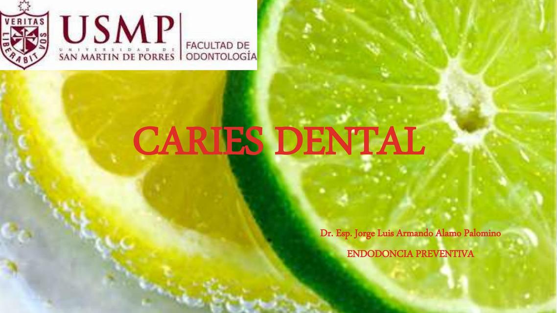 Caries Dental