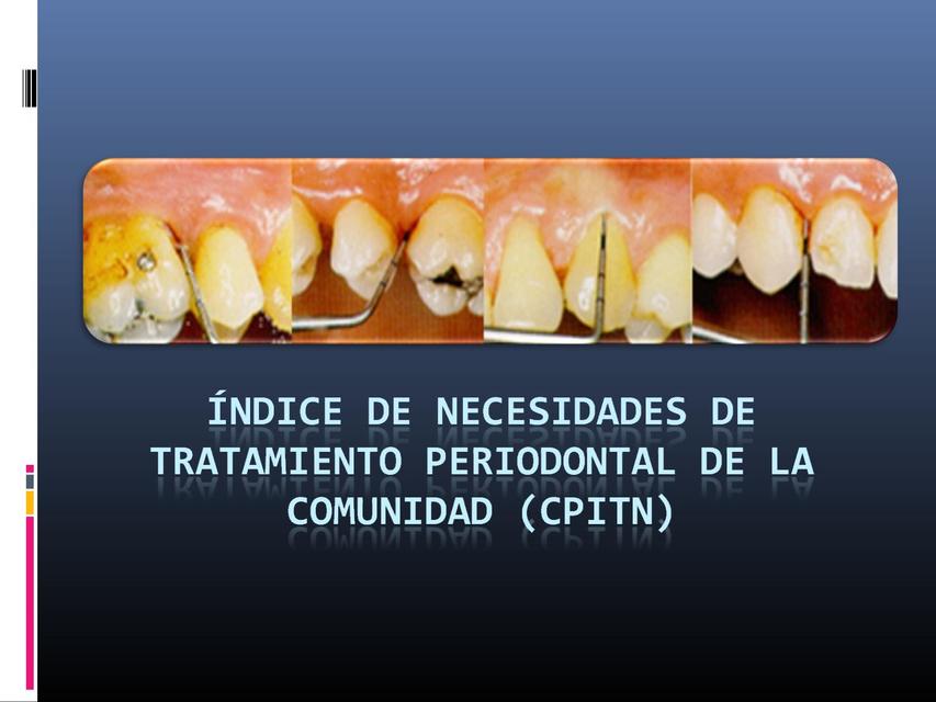 CPITN INDICE DE NECESIDADES DE TRATAMIENTO PERIODONTAL COMUNITARIO