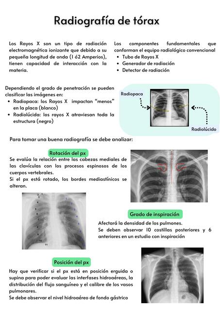 Radiografía de tórax