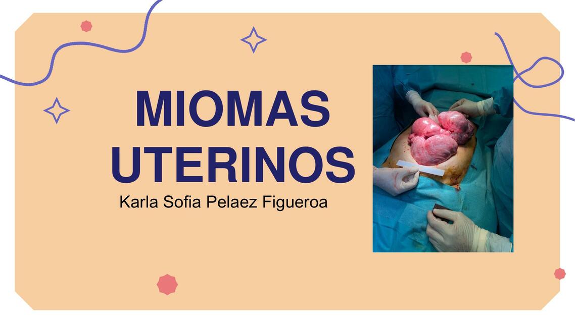 MIOMATOSIS UTERINA SEMANA 3