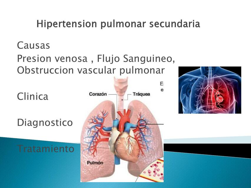 Hipertension pulmonar secundaria