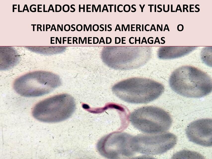 Enfermedades de chagas 