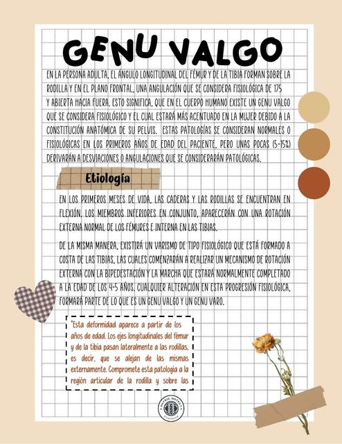 Genu valgo