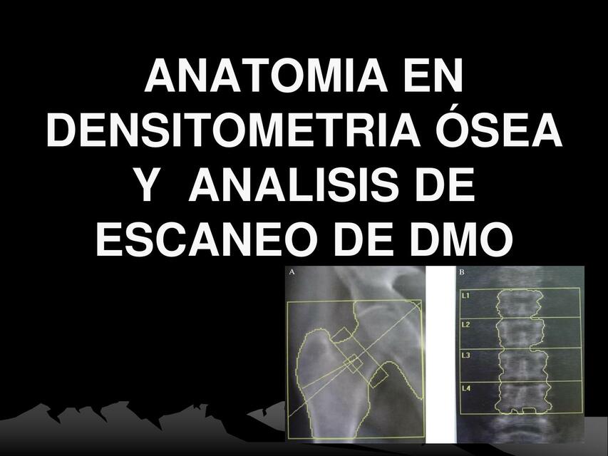 ANATOMIA EN DENSITOMETRIA OSEA Y ANALISI