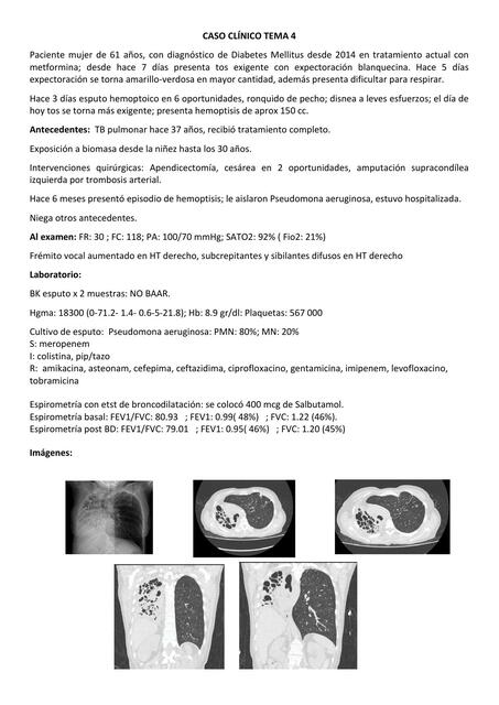 CASO CLÍNICO TEMA 4 BRONQUIECTASIAS 2DA UNIDAD doc