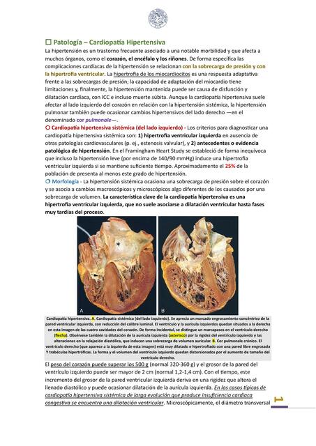 Patologia - Cor pulmonale