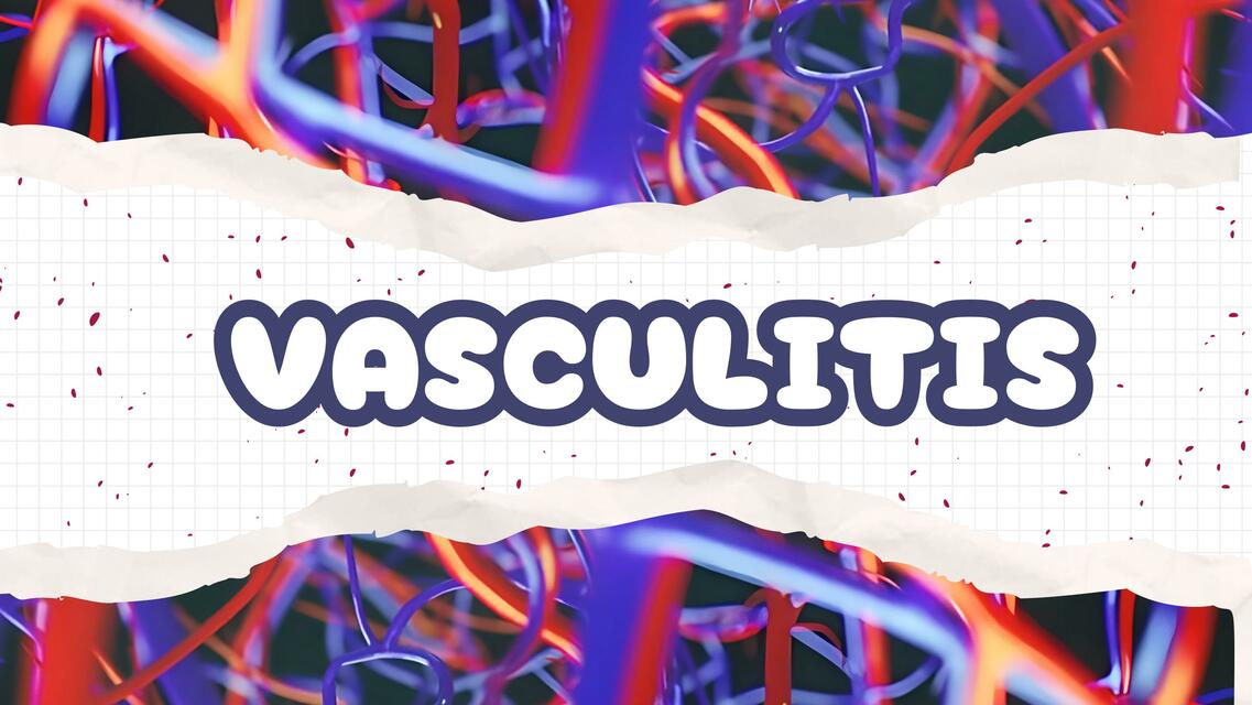 VASCULITIS