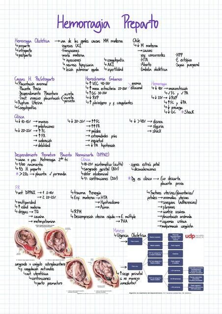 Hemorragia Preparto